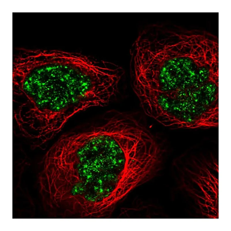 Atlas Antibodies Anti-C11orf84 Antibody