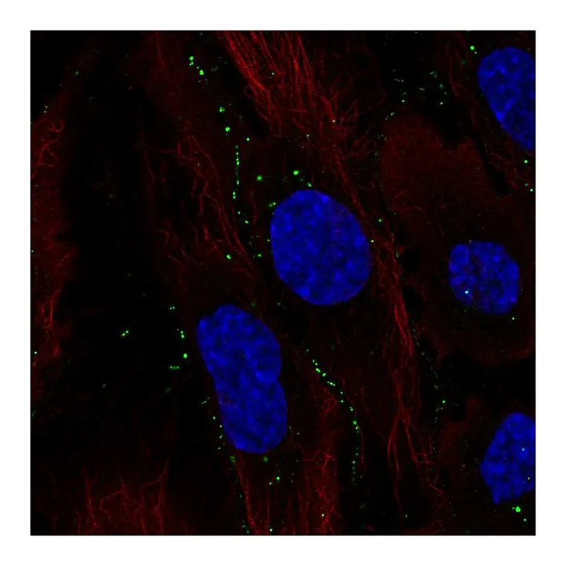 Atlas Antibodies Anti-C11orf91 Antibody