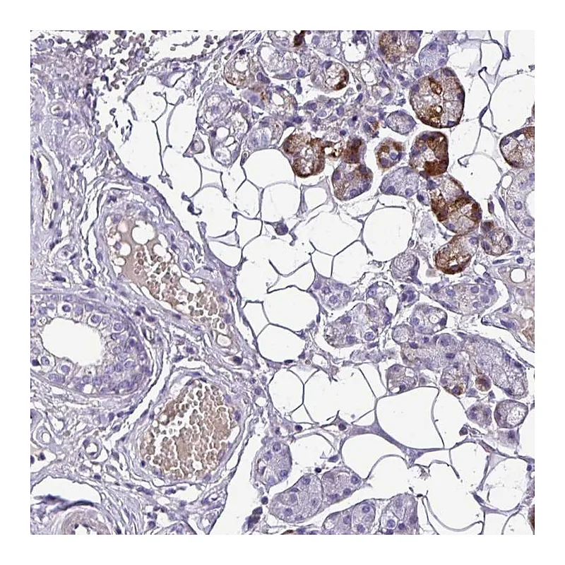 Atlas Antibodies Anti-C11orf91 Antibody