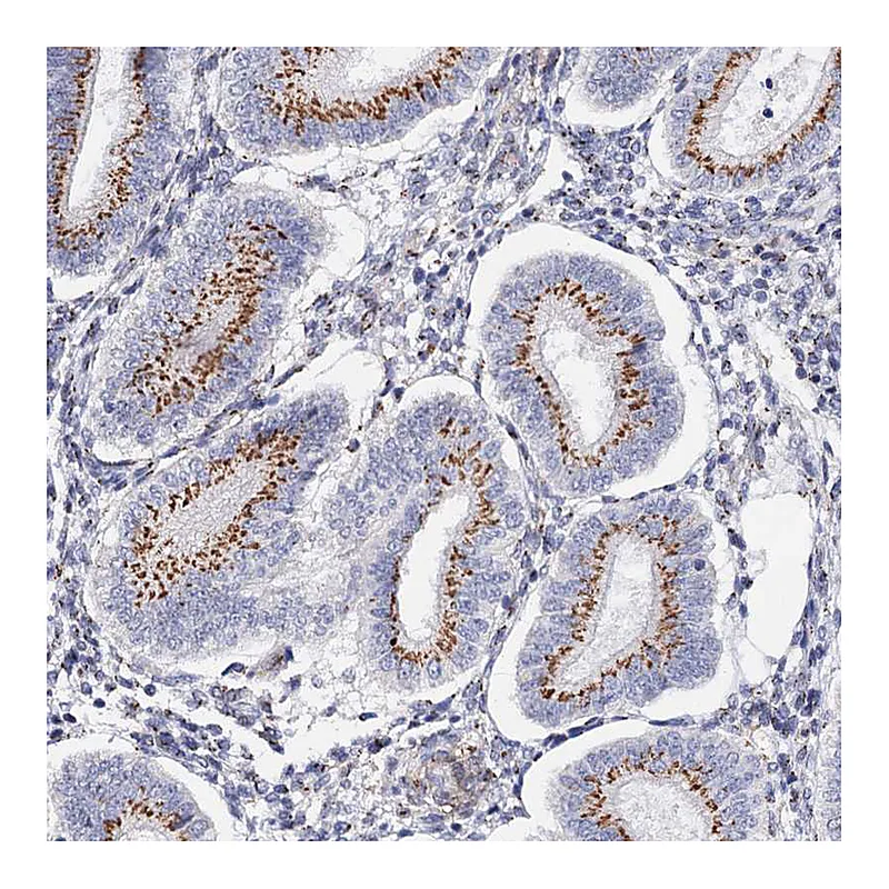 Atlas Antibodies Anti-C11orf96 Antibody