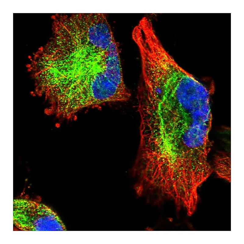 Atlas Antibodies Anti-C11orf95 Antibody