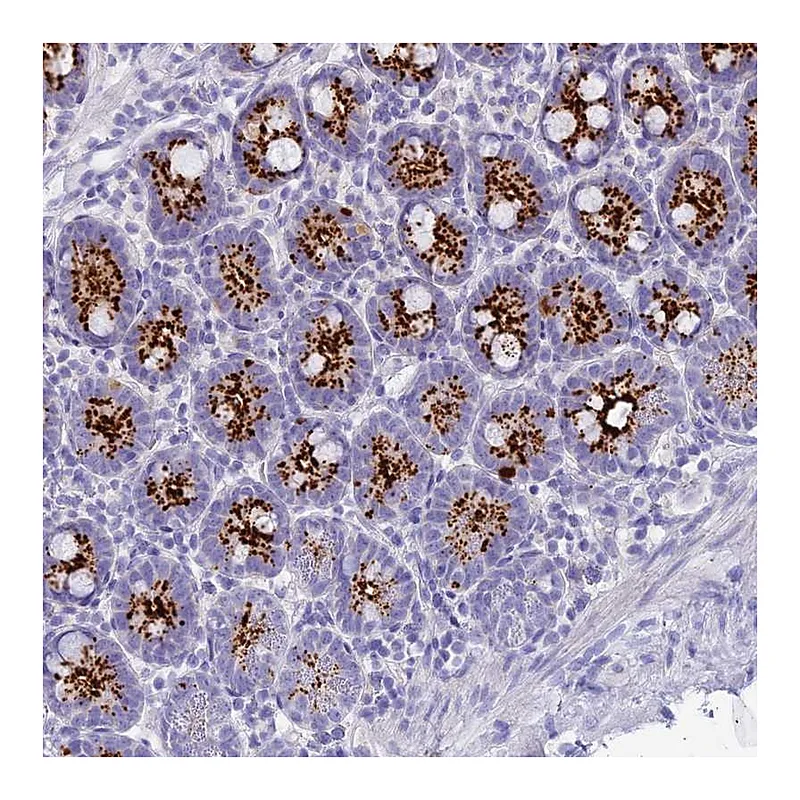 Atlas Antibodies Anti-C12orf29 Antibody