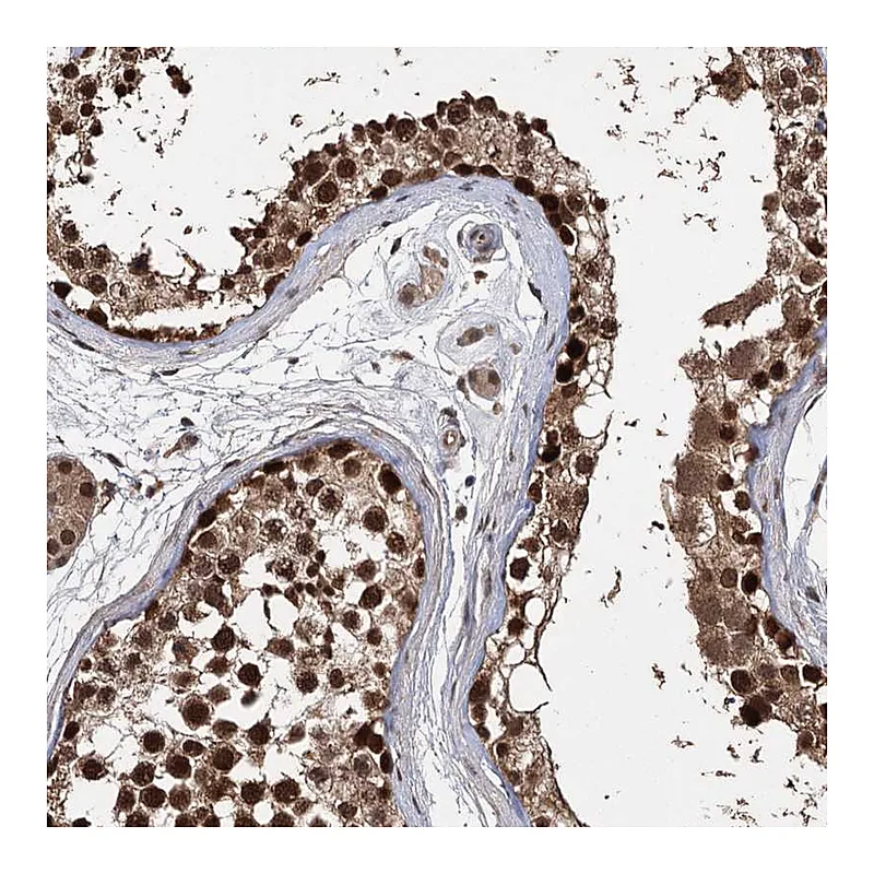 Atlas Antibodies Anti-C12orf10 Antibody