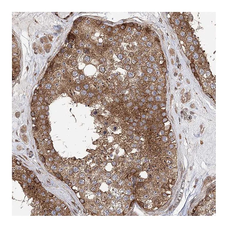 Atlas Antibodies Anti-C12orf4 Antibody