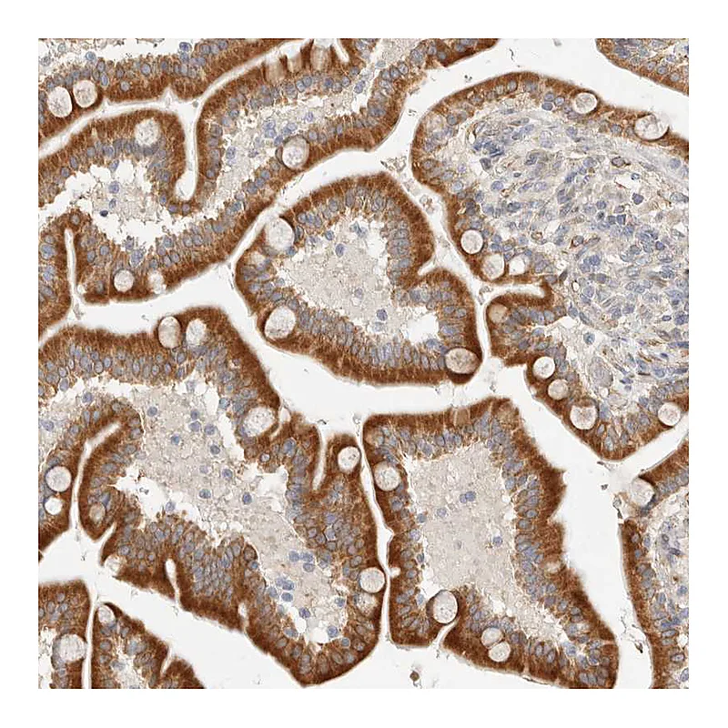 Atlas Antibodies Anti-C12orf49 Antibody