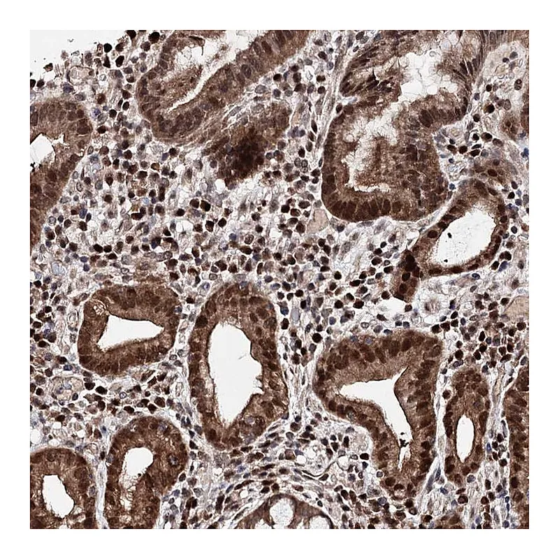 Atlas Antibodies Anti-C12orf45 Antibody