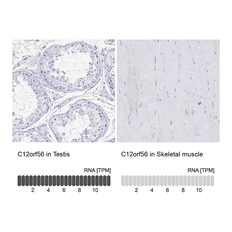 Atlas Antibodies Anti-C12orf56 Antibody
