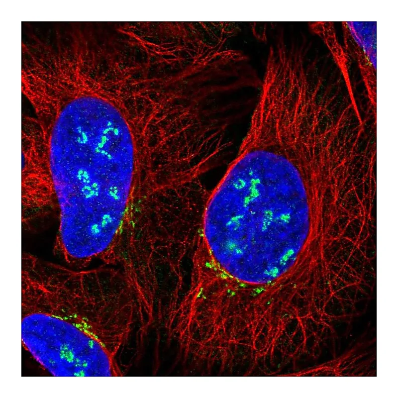 Atlas Antibodies Anti-C12orf43 Antibody