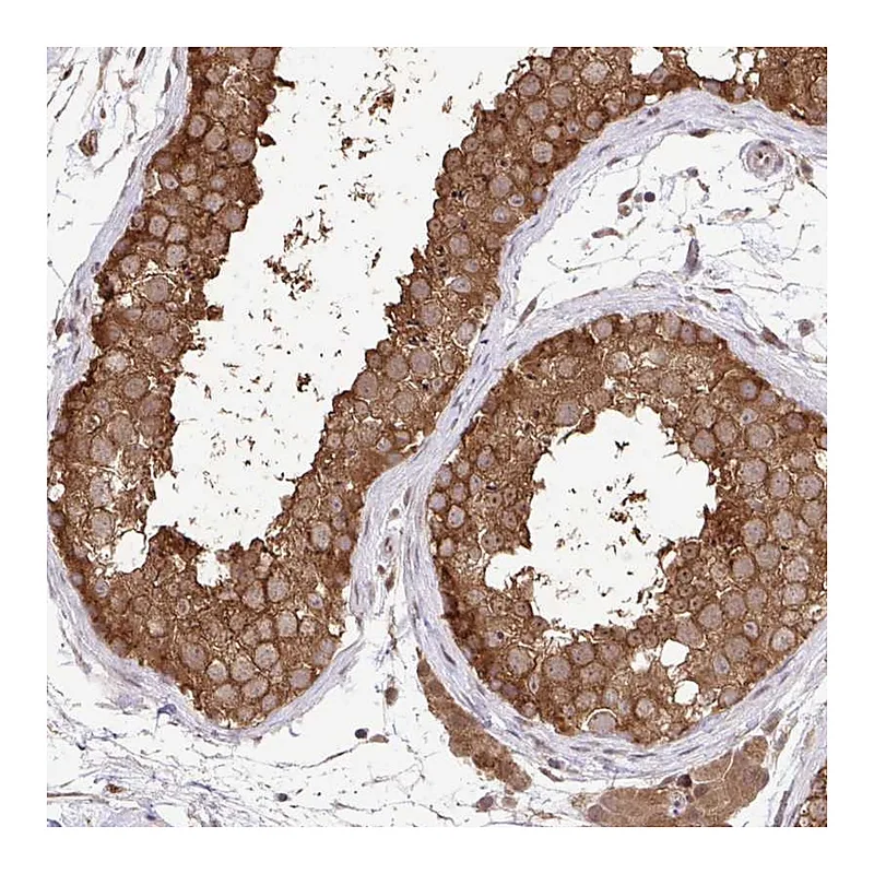 Atlas Antibodies Anti-C12orf57 Antibody
