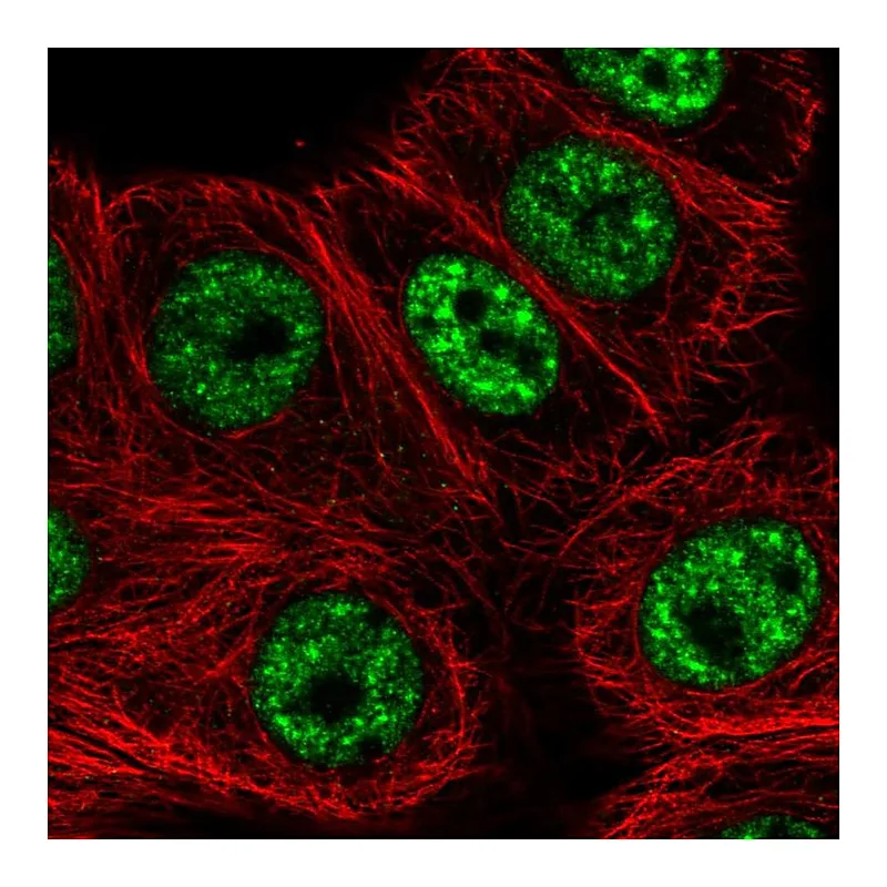 Atlas Antibodies Anti-C12orf57 Antibody