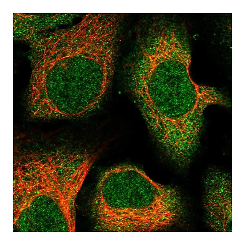 Atlas Antibodies Anti-C12orf60 Antibody