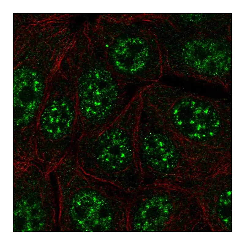 Atlas Antibodies Anti-C12orf57 Antibody