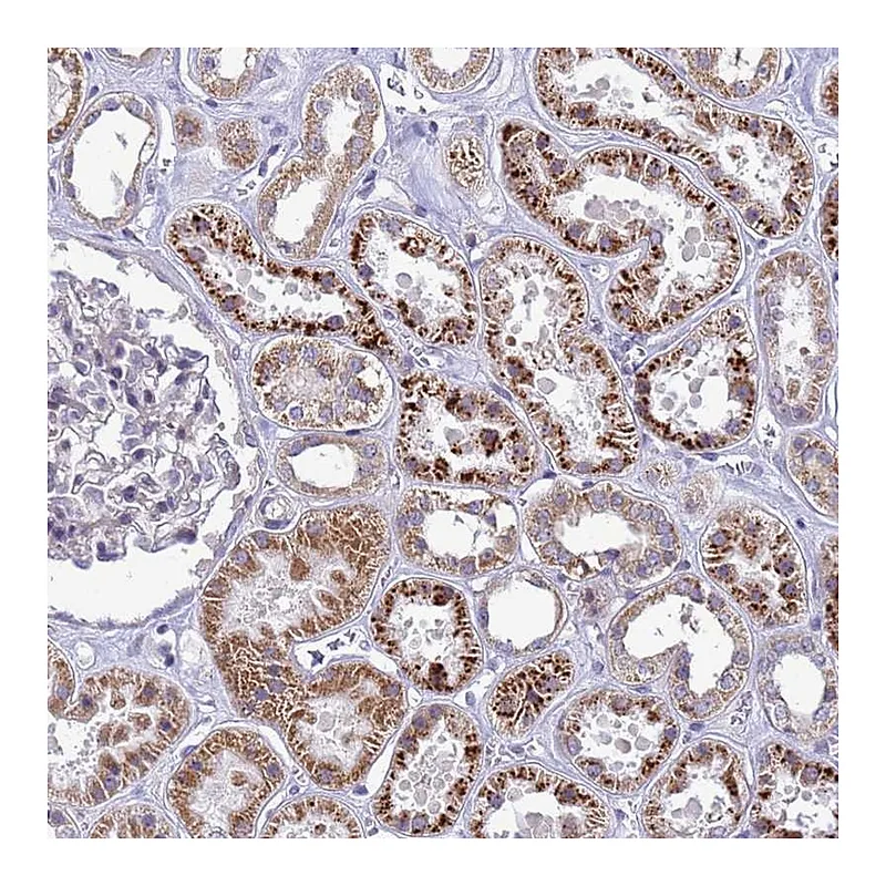Atlas Antibodies Anti-C12orf43 Antibody