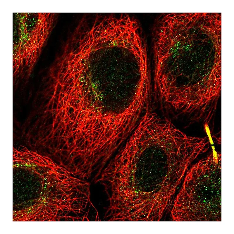 Atlas Antibodies Anti-C12orf66 Antibody