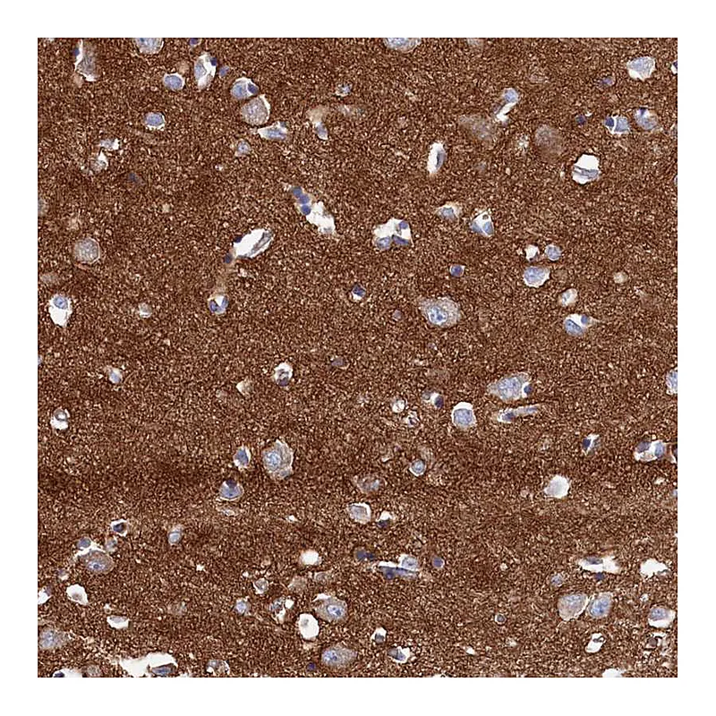 Atlas Antibodies Anti-C12orf73 Antibody