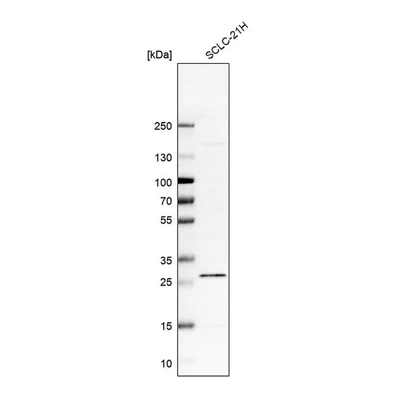 Atlas Antibodies Anti-C12orf65 Antibody
