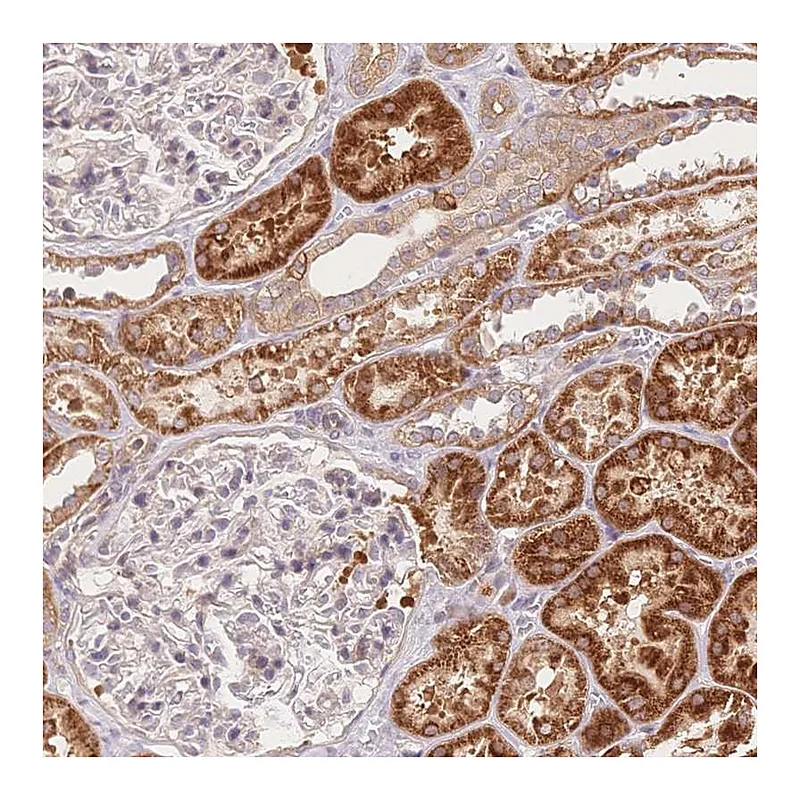 Atlas Antibodies Anti-C12orf75 Antibody