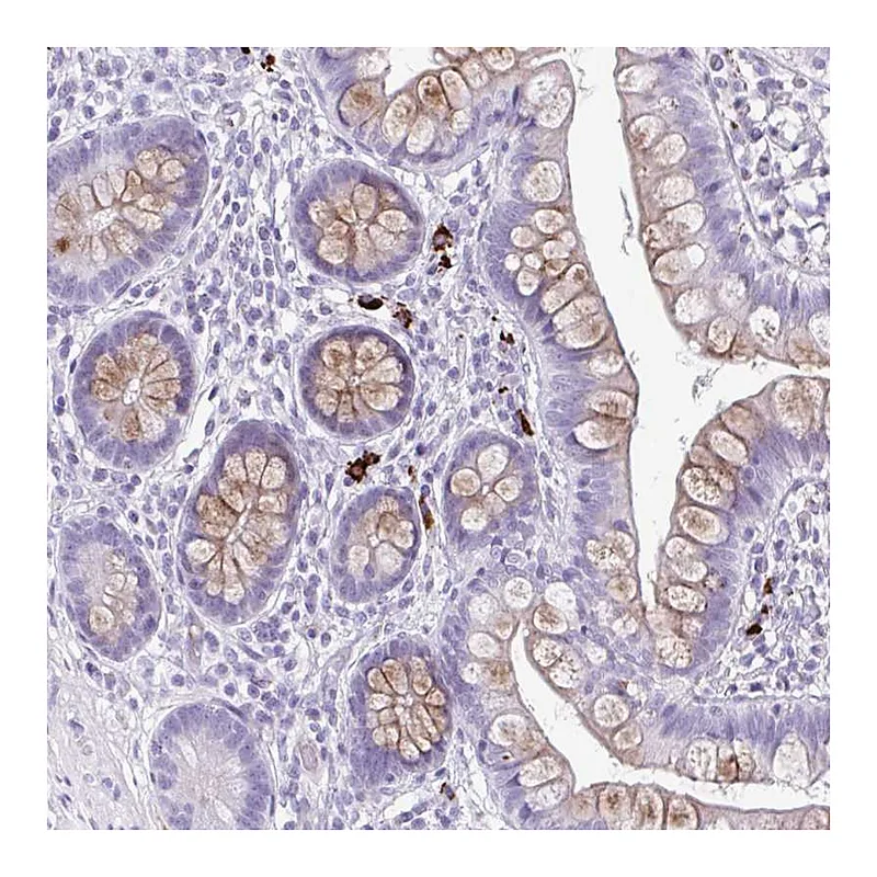 Atlas Antibodies Anti-C12orf71 Antibody