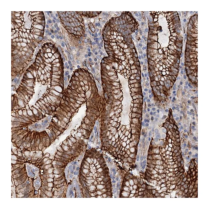 Atlas Antibodies Anti-C12orf76 Antibody