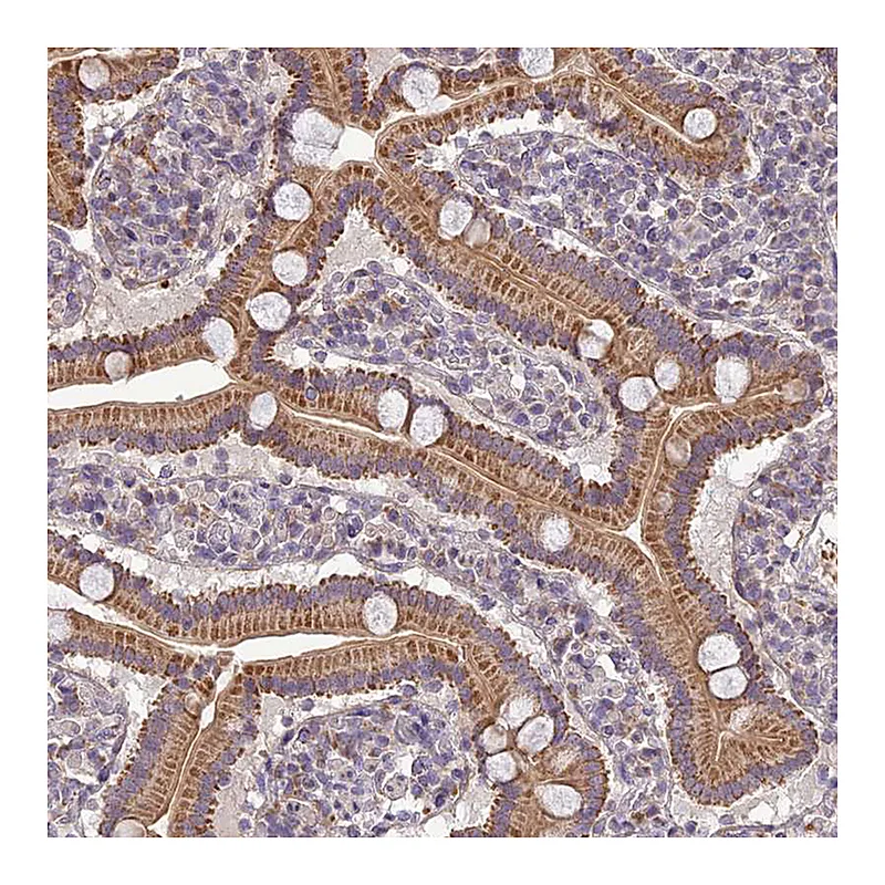 Atlas Antibodies Anti-C14orf1 Antibody