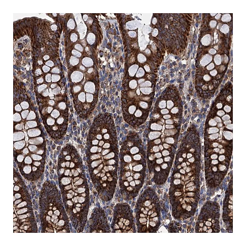 Atlas Antibodies Anti-C14orf159 Antibody