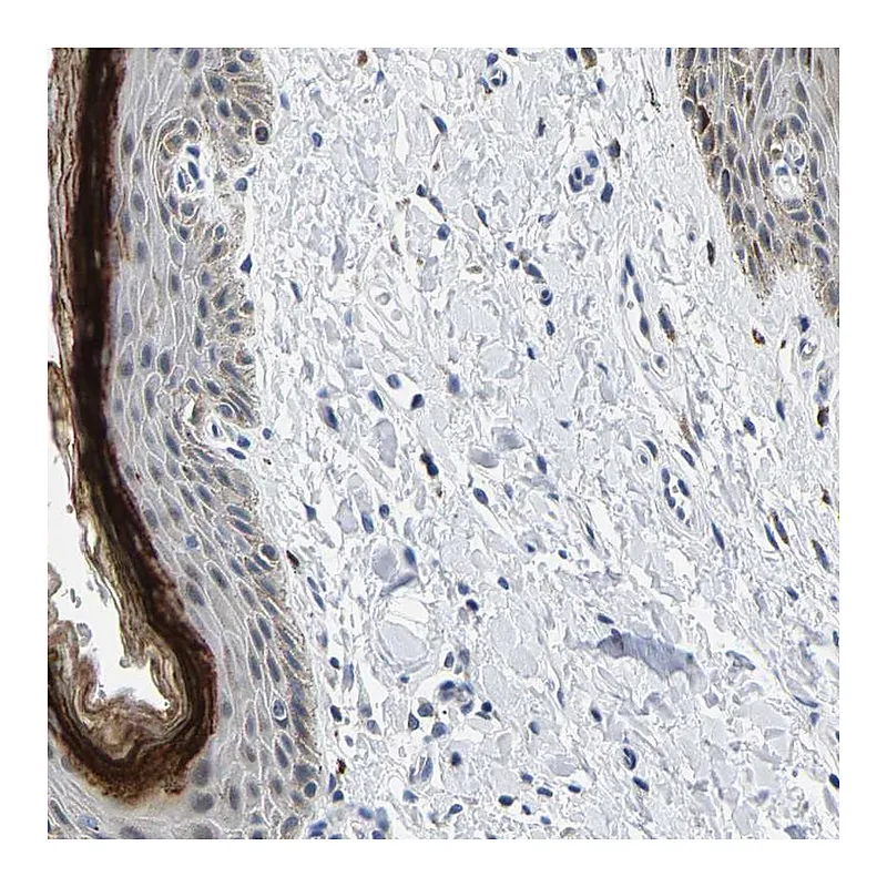 Atlas Antibodies Anti-C14orf177 Antibody