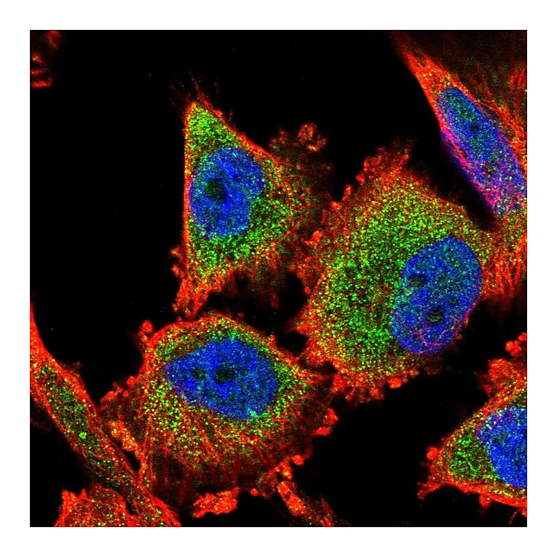Atlas Antibodies Anti-C14orf159 Antibody