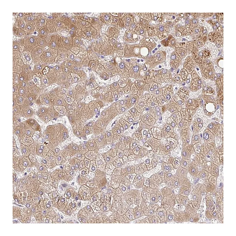 Atlas Antibodies Anti-C14orf178 Antibody