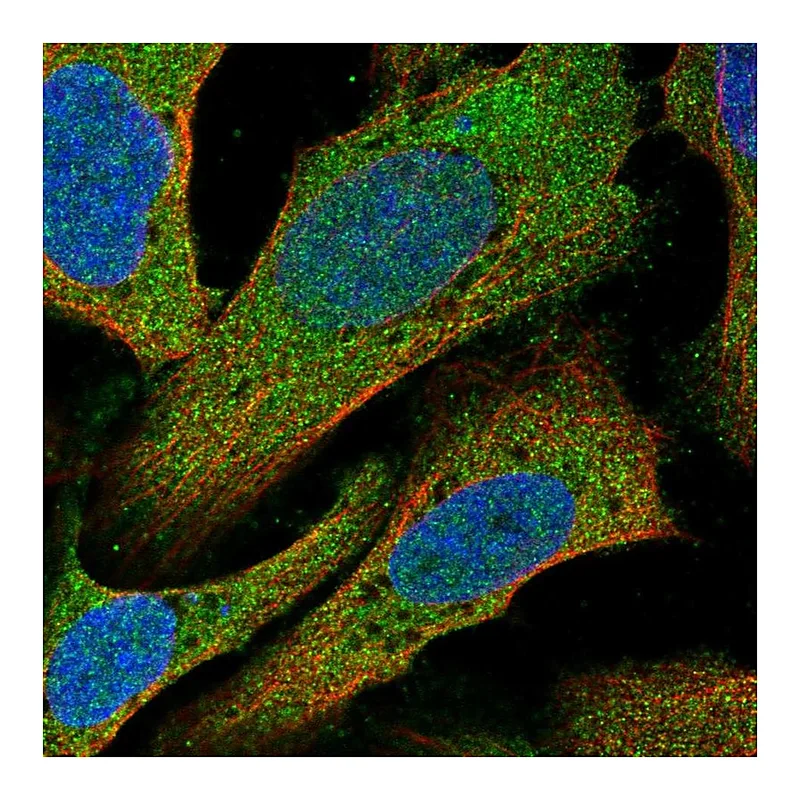 Atlas Antibodies Anti-C14orf28 Antibody