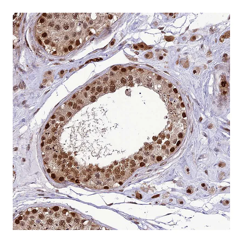 Atlas Antibodies Anti-C14orf166 Antibody