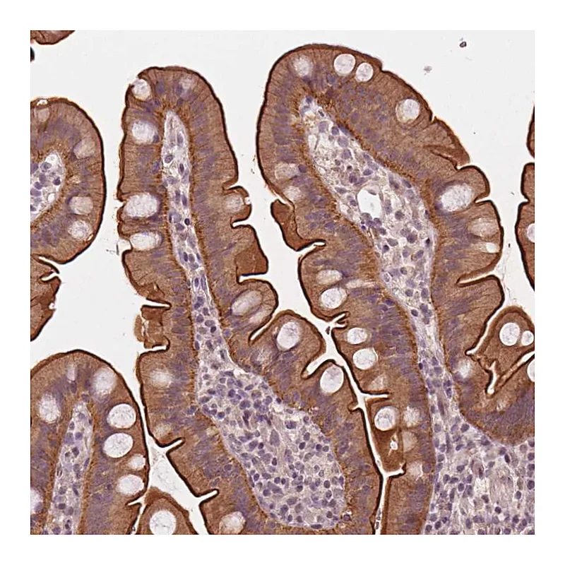 Atlas Antibodies Anti-C14orf79 Antibody