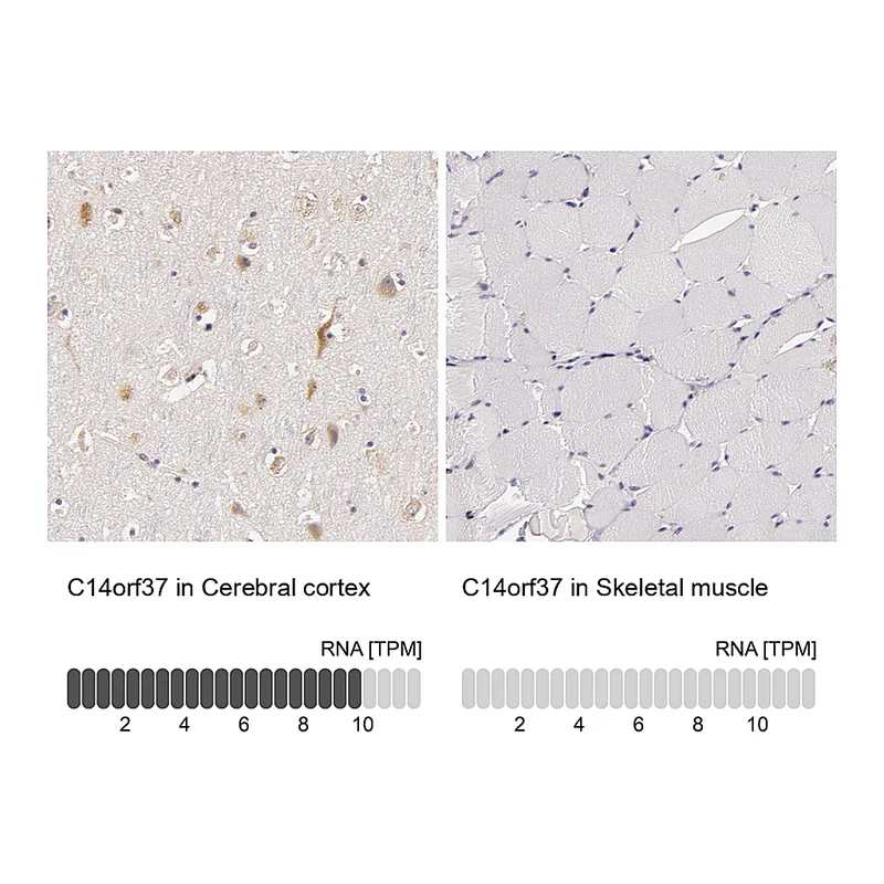 Atlas Antibodies Anti-C14orf37 Antibody