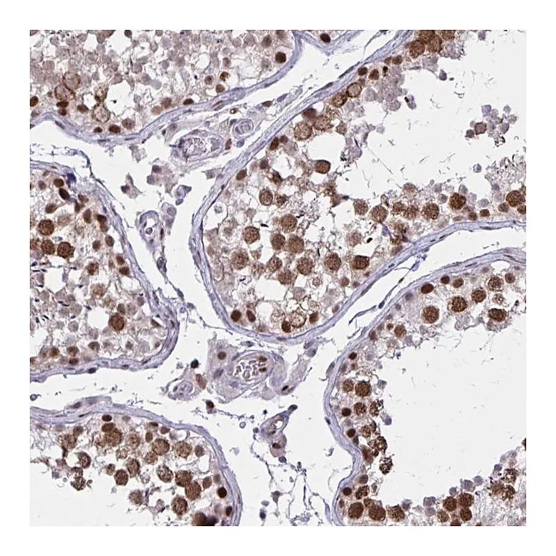 Atlas Antibodies Anti-C14orf39 Antibody