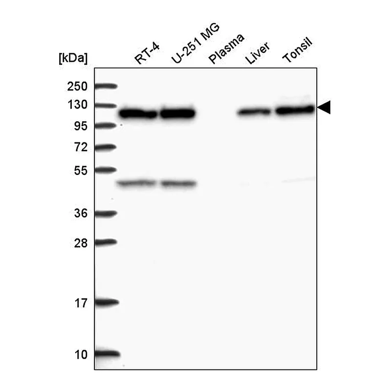 Atlas Antibodies Anti-C15orf39 Antibody