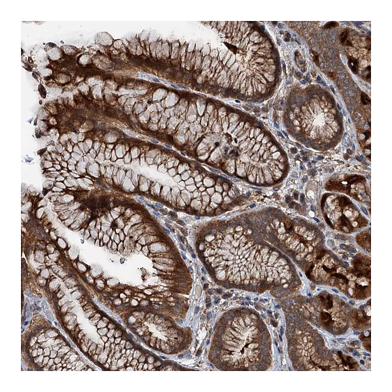 Atlas Antibodies Anti-C14orf80 Antibody