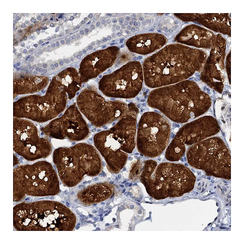 Atlas Antibodies Anti-C15orf39 Antibody