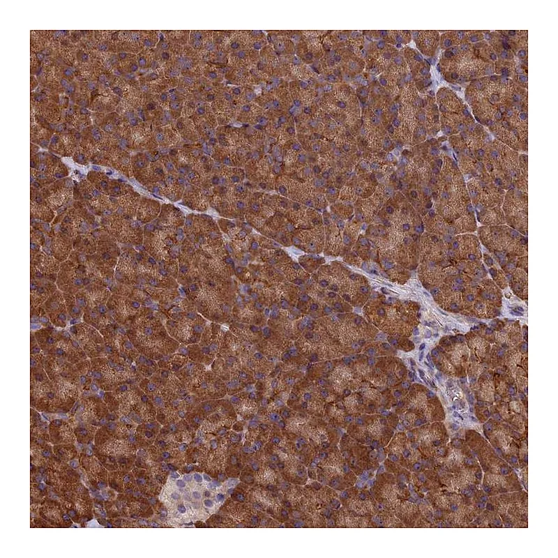 Atlas Antibodies Anti-C15orf52 Antibody