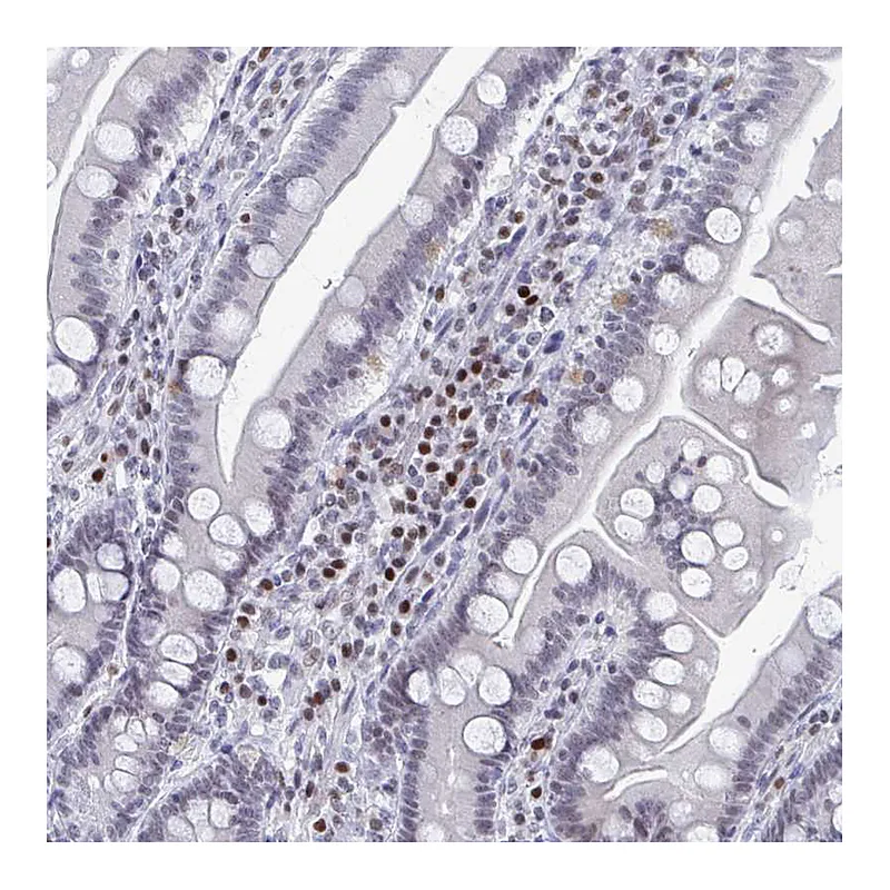 Atlas Antibodies Anti-C15orf41 Antibody