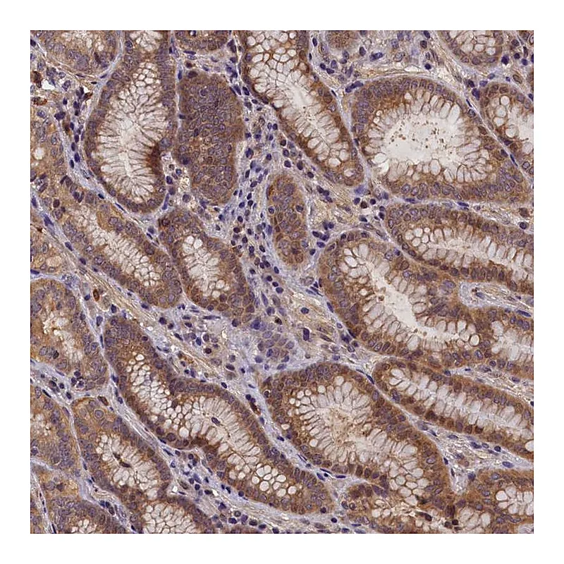 Atlas Antibodies Anti-C15orf52 Antibody
