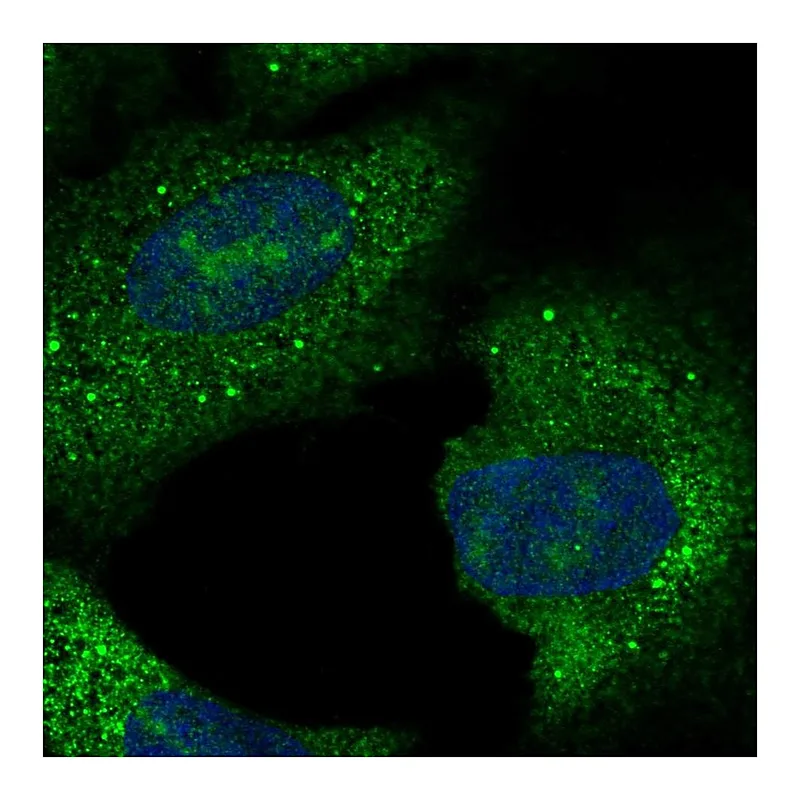 Atlas Antibodies Anti-C15orf61 Antibody