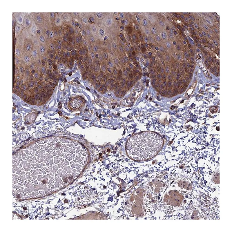 Atlas Antibodies Anti-C15orf62 Antibody