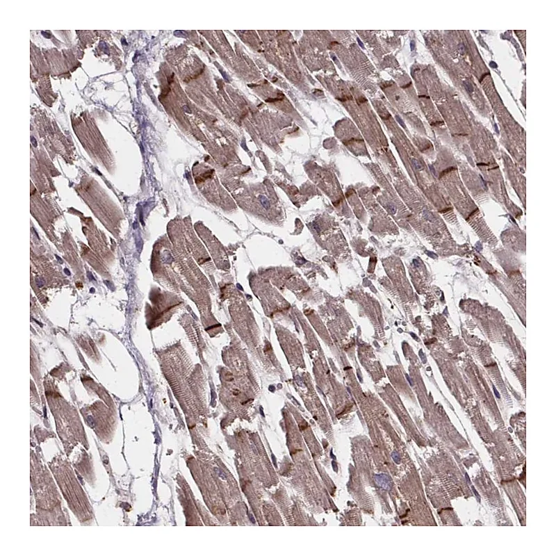 Atlas Antibodies Anti-C15orf65 Antibody