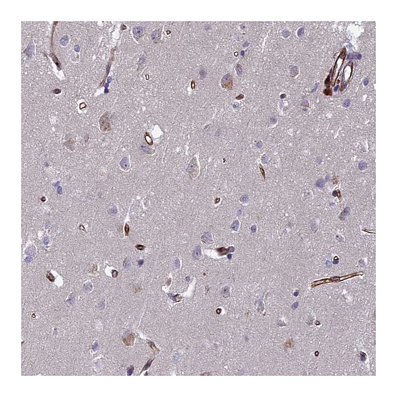 Atlas Antibodies Anti-C15orf59 Antibody