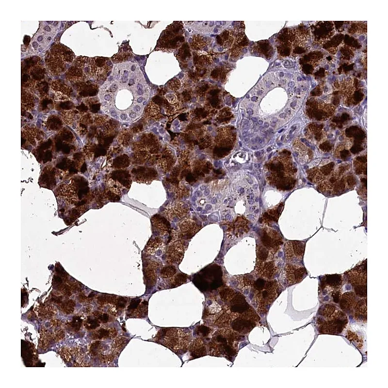 Atlas Antibodies Anti-C15orf57 Antibody