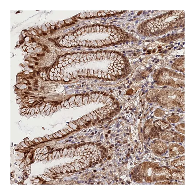 Atlas Antibodies Anti-C16orf46 Antibody