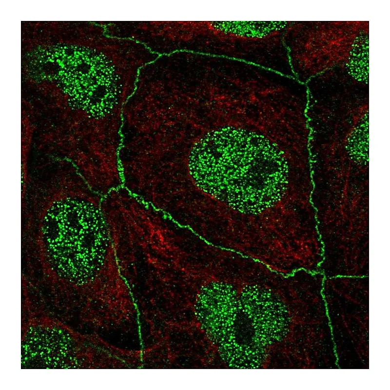 Atlas Antibodies Anti-C16orf59 Antibody