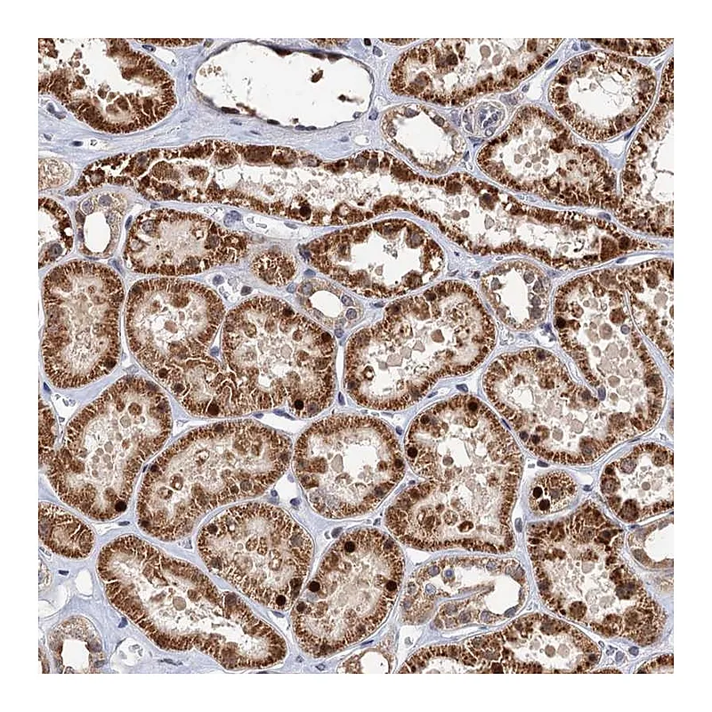 Atlas Antibodies Anti-C16orf45 Antibody