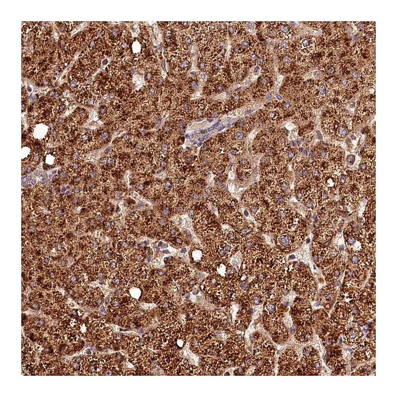 Atlas Antibodies Anti-C16orf46 Antibody