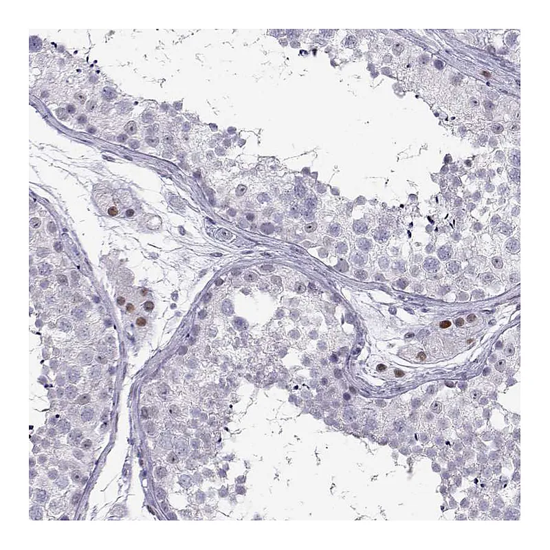 Atlas Antibodies Anti-C16orf59 Antibody