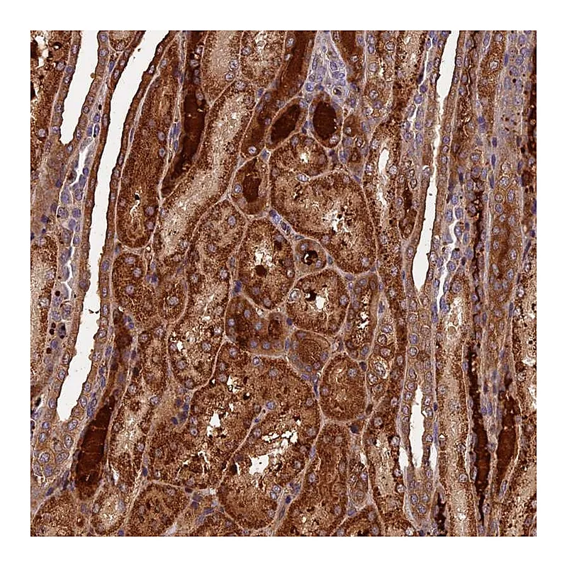 Atlas Antibodies Anti-C16orf70 Antibody